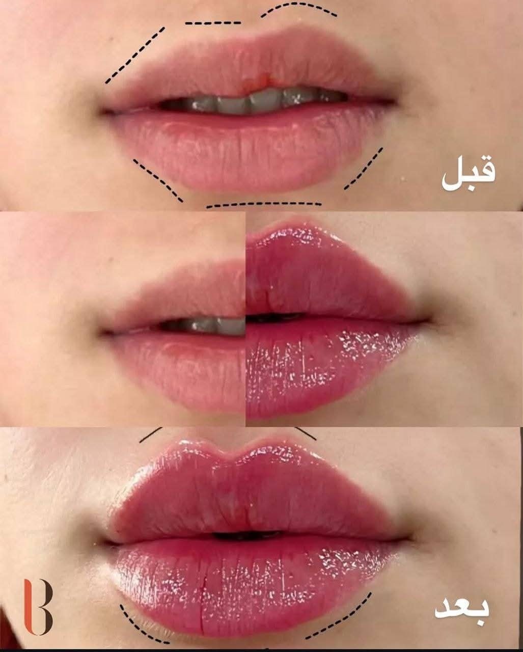 فيلر روز بيري